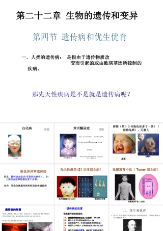 八年级生物下册 第二十二章 第四节 遗传病和优生优育课件2 （新版）苏教版