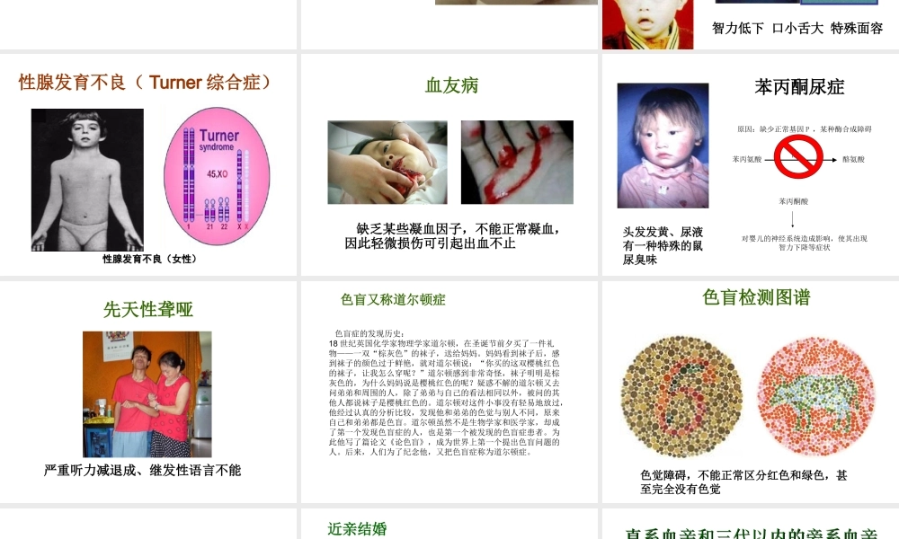 八年级生物下册 第二十二章 第四节 遗传病和优生优育课件3 （新版）苏教版