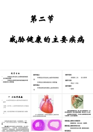 八年级生物下册 第二十五章 第二节 威胁健康的主要疾病课件1 （新版）苏教版