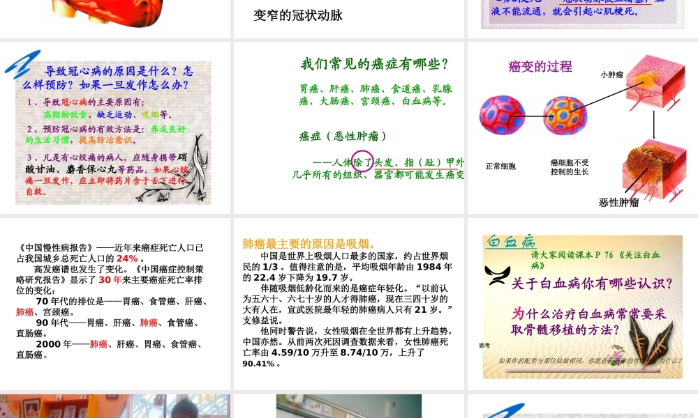 八年级生物下册 第二十五章 第二节 威胁健康的主要疾病课件3 （新版）苏教版