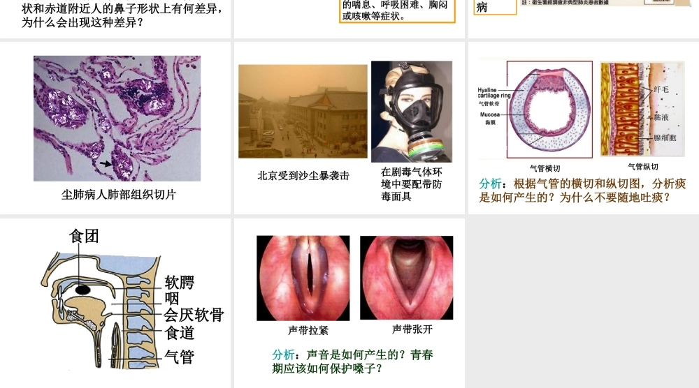 安徽省合肥市长丰县七年级生物下册 4.3.1 呼吸道对空气的处理课件3 （新版）新人教版-（新版）新人教版初中七年级下册生物课件