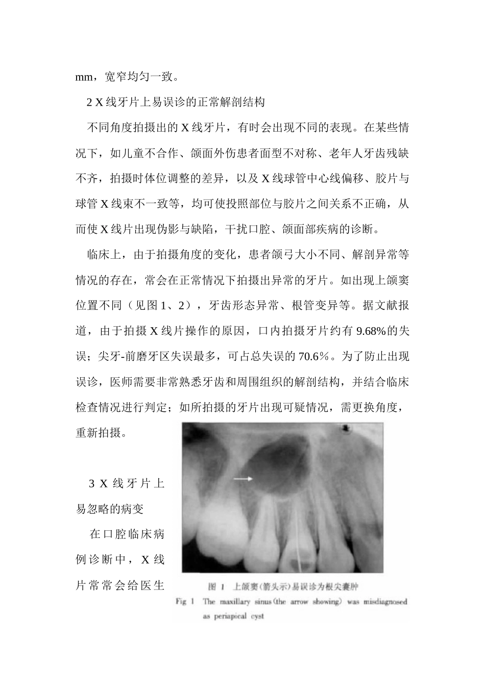 线牙片在牙齿疑难病例诊断中的参考价值_第2页