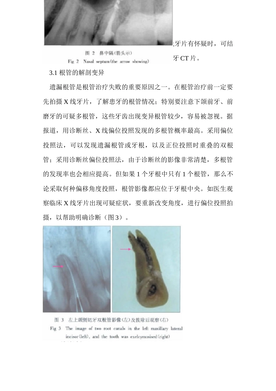 线牙片在牙齿疑难病例诊断中的参考价值_第3页